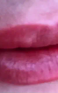 شیدینگ لب میکروبلیدینگ وخط.چشم وریموو‌تتوی قدیمی