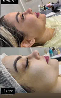 آموزش فشیال صورت. پاکسازی تخصصی و مدل پاکسازی پوست