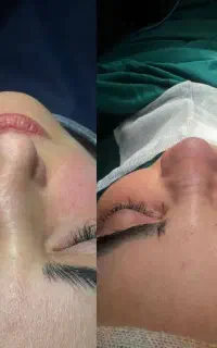 تا پایان ماه عمل بینی فقط و فقط ۴۷تومن