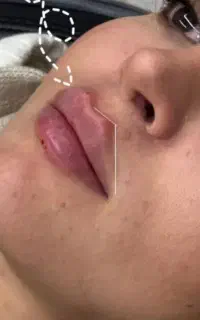 مزو سفید کننده تضمینی 700پی ار پی600 فیلر 800