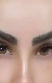 کاشت مژه
