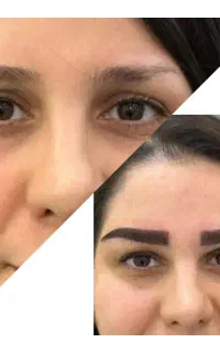 زیبایی بیشتر با کاشت ابرو دائمی و طبیعی