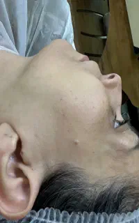 مدل برای درماپلنینگ ۲۰٪ تخفیف