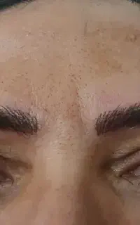 میکرو فیبروز شید لب خط چشم