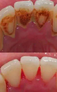 ارائه خدمات دندانپزشکی با تعرفه دولتی
