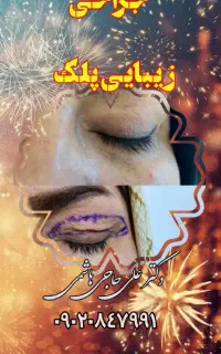 عمل پلک بالا و پائین توسط پزشک فوق تخصص