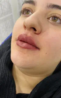 کلینیک زیبایی ژل فیلربادی نخ بوتاکس لیزرلاغری قسطی