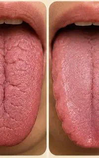 تشخیص بیماری ها