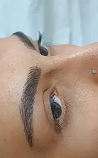فیبروز ابرو