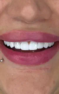 دندانپزشکی آلیرا