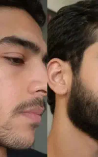 ماژول تکامل ریش