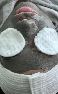فیشال تخصصی در مطب زیبایی