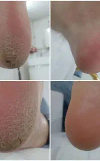 پدیکور خیس