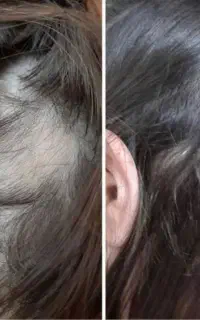 این آخرین راهکار درمانته