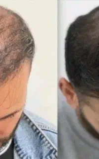 باید بزنی تا بلند بشه