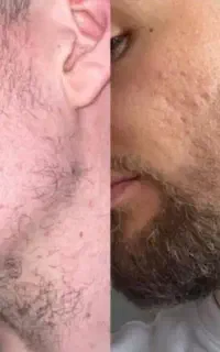 کاشت ممنوع