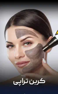 تخفیف کربن تراپی و روشن کنندگی با لیزر