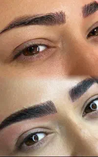 میکرو بلیدینگ تخفیف ویژه