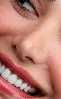 جشنواره  خدمات زیبایی دندان کامپوزیت