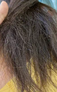 تخفیف موخوره گیری روسی