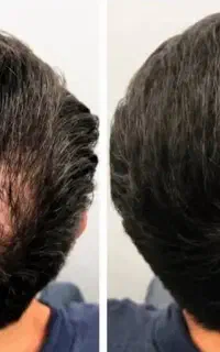 تار پرپشتی موهات دست منه