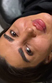 فیلر ژل و بوتاکس اموزش ژل و بوتاکس تخفیف