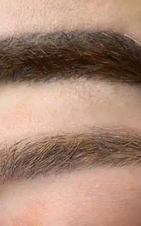 ریموو و پاک کردن تخصصی تتو ابرو