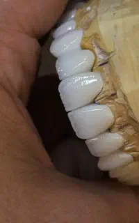 آموزش پودر (پرسلن) گذاری لایرینگ