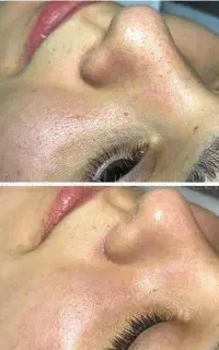 فیشال با برند اکلادو