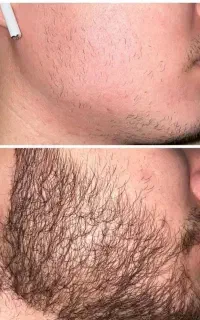 از افسردگی نجاتت میدم