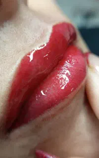 رفع تیرگی دائم لب با هر قیمتی که خودت خواستی