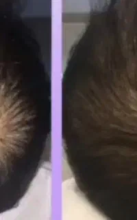 بازگشت شادابی مو