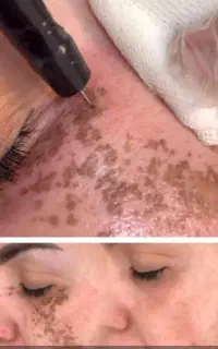 انجام خدمات زیبایی برای خانم ها و آقایون
