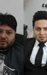 داماد ، اصلاح گریم فشیال