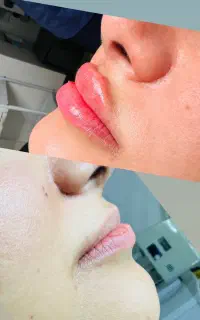 خدمات فیشیال تخصیی درمان لک ،جوش ،ژل بوتاکس ،آموزش