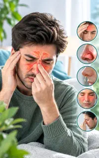 سینوزیت داری این مال توعه