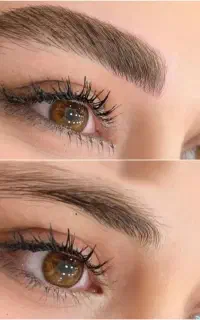 فیبروز(نچرال) و میکروتضمینی