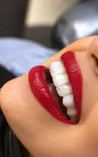 متخصص عصب کشی /درمان ریشه / اقساط 12 ماهه