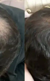 نهال موهات رو دریاب