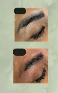 ریمو تخصصی تتو ابرو با لیزر