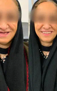 سلامت وزیبایی دندان