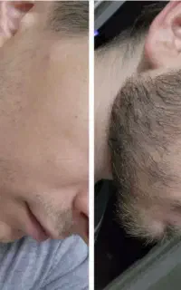ریشو مردونگی