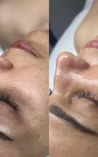 اموزش پاکسازی پوست