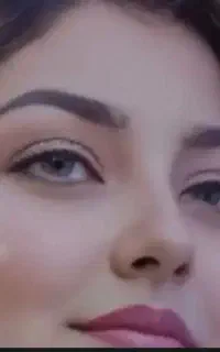 چاقی صورت