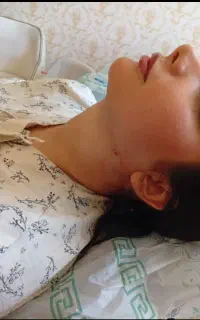 ساکشن و چربی