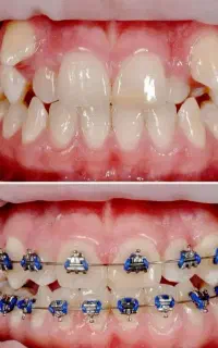 دندانپزشکی و ارتودنسی با حداقل پیش پرداخت