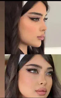 جراحی بینی فقط با مبلغ ۴۰ میلیون