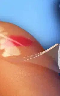 اولین کارشناس تخصصی زخم در کازرون
