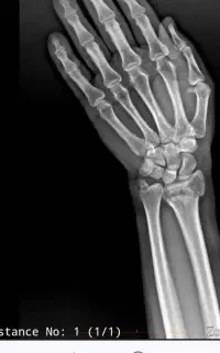 جابجایی شغلی پرستار