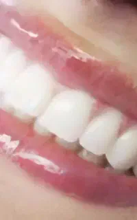 لمینته اس کا ال